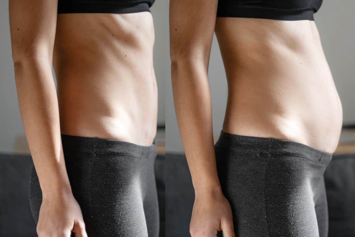 How long does diastasis recti take to improve Melton Mowbray?