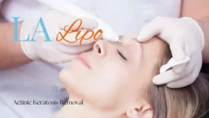 Woman receiving Actinic Keratosis Removal Treatment Melton Mowbray