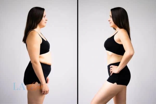 LA-EMS Body Sculpting Melton Mowbray results before and after of womans results on body toning.
