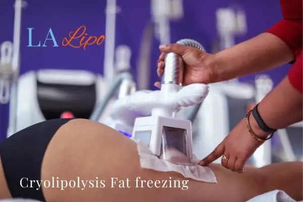women getting fat freezing Melton Mowbray