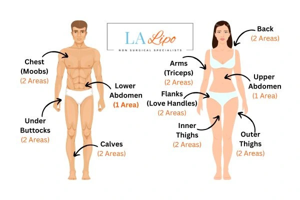 LA LIPO Cryolipolysis Areas Melton Mowbray