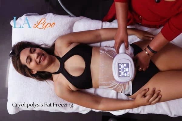 woman getting cryolipolysis Melton Mowbray