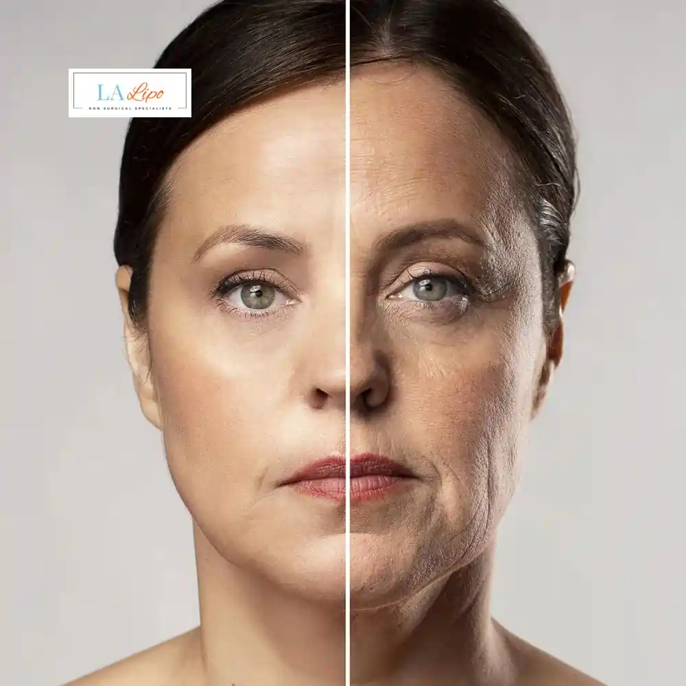 How Can You Tell If Non-Surgical Skin Tightening Is Right for You Melton Mowbray?