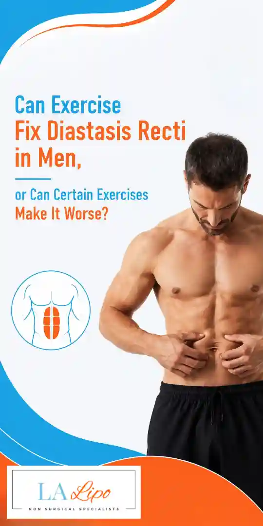 Can Exercise Fix Diastasis Recti in Men, or Can Certain Exercises Make It Worse Melton Mowbray?